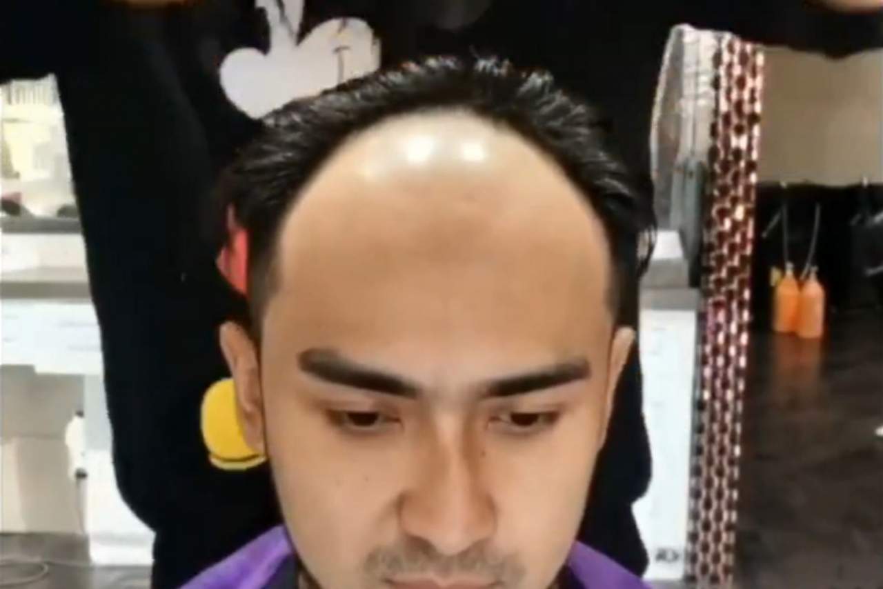 My Special Hair: prótesis capilares para hombre