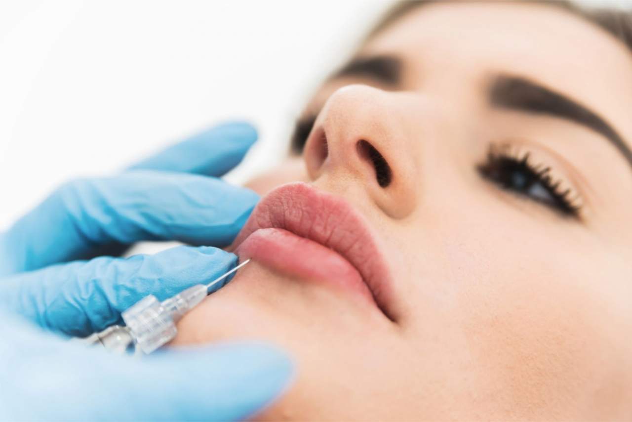 Clínica Dr. Zito: Aumento de labios