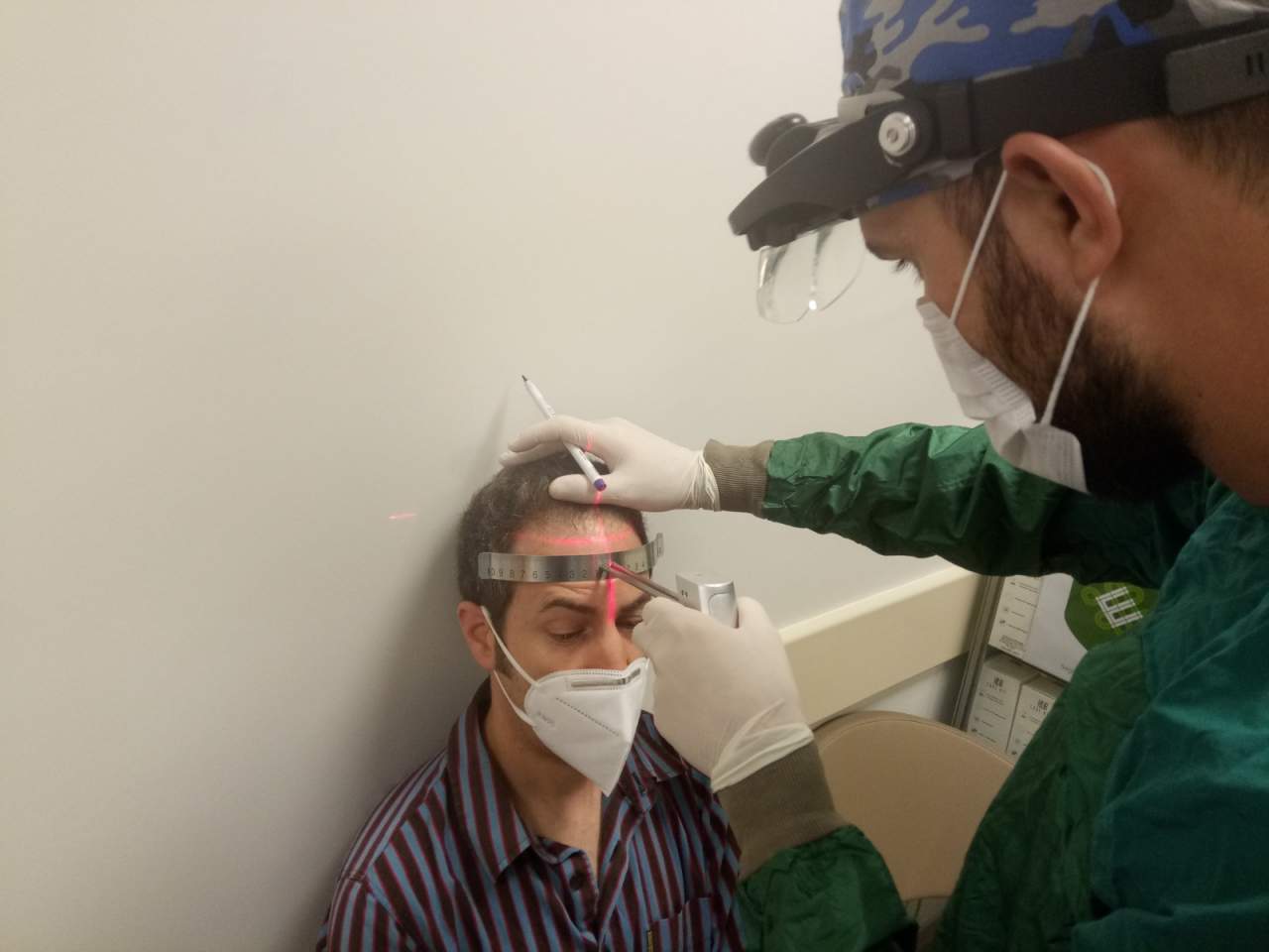 Turismo capilar en Turquía en Fue Hair Transplant System