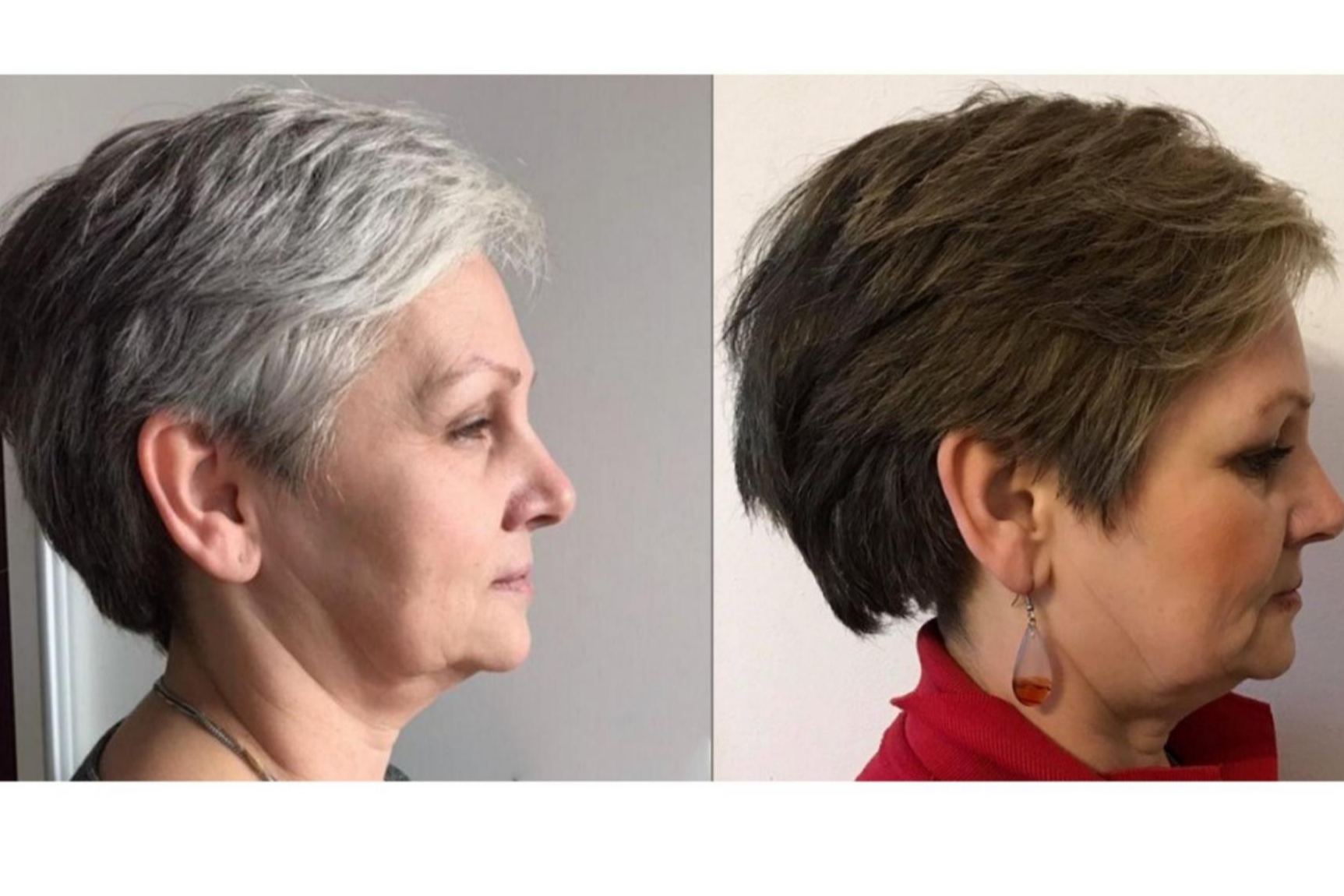 Loción GR-7 Professional: Cómo tapar las canas sin tinte gracias a la loción