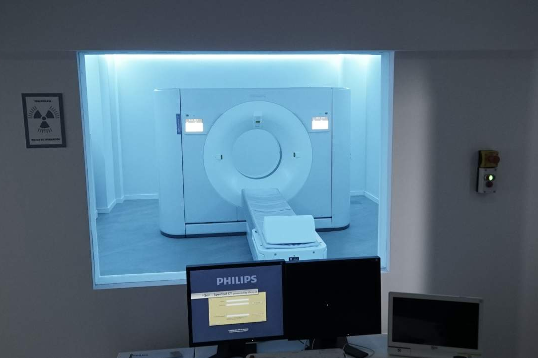 ¿Cómo prevenir patologías cardiovasculares? Escáner médico de detección espectral