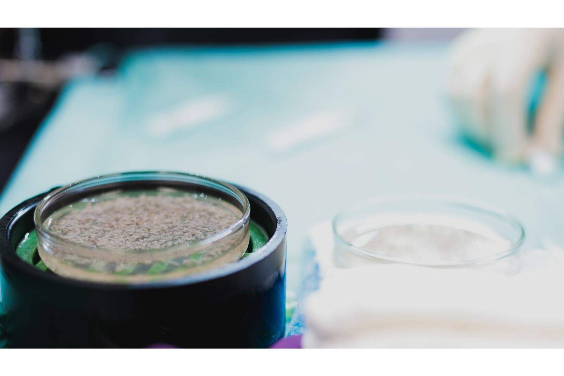 Los microinjertos de barba ycejas que se realizan en la Clínica Adcure cada vez son más populares