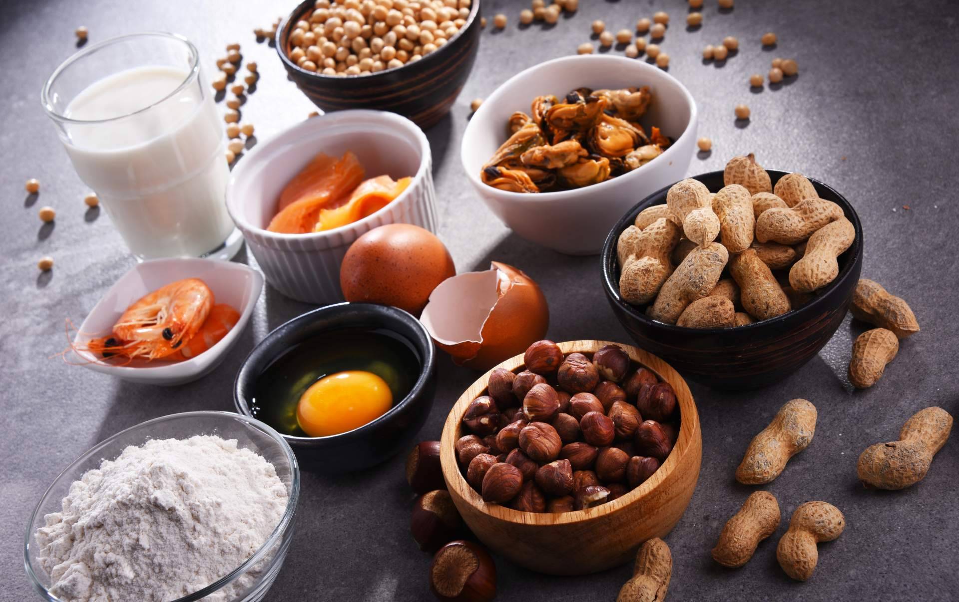 Las intolerancias alimentarias no son irreversibles: UMEBIR