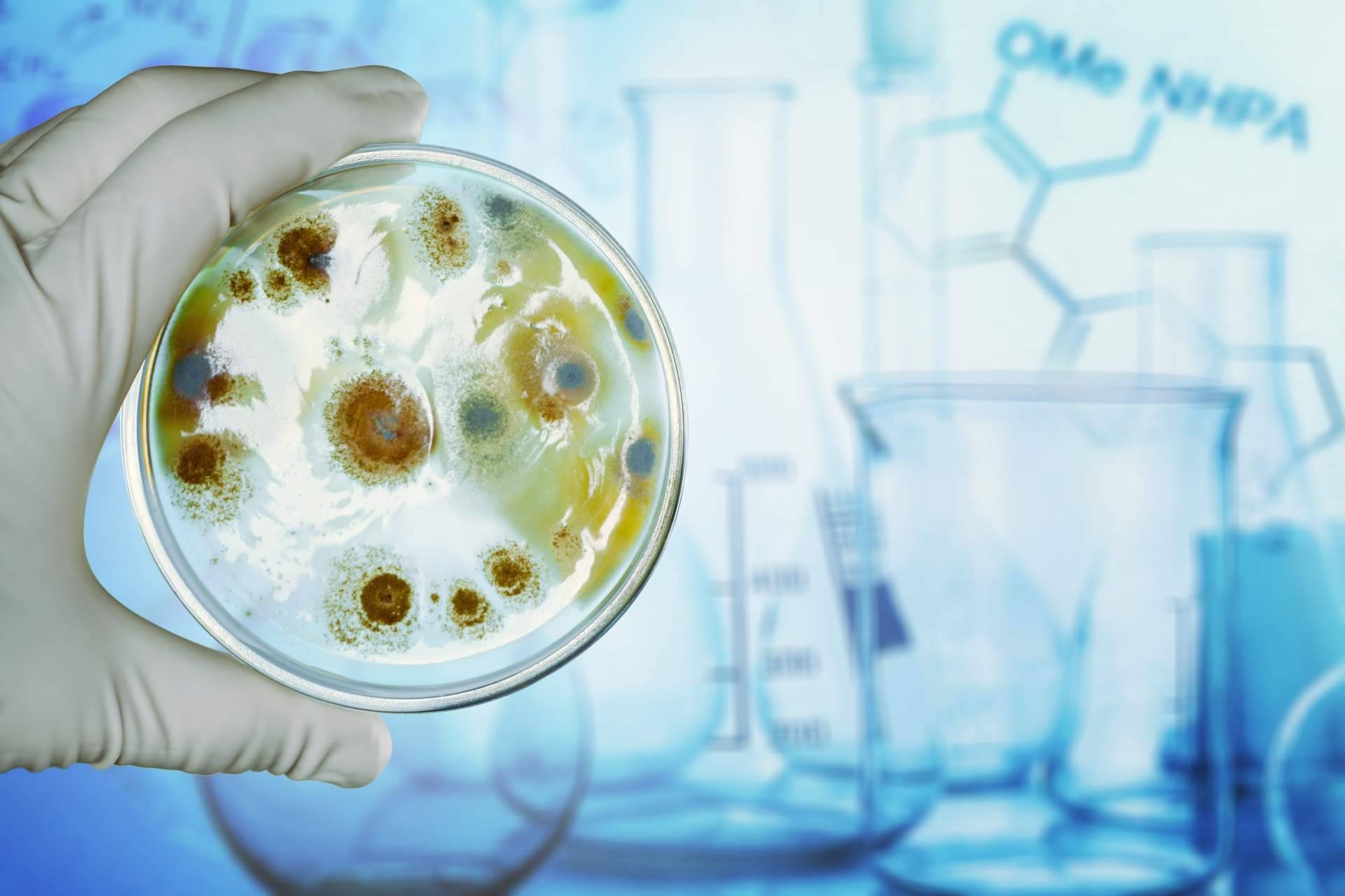 El director de la unidad de microbiota intestinal UMEBIR: entrevista al Dr. Fernando Ruger Viarengo