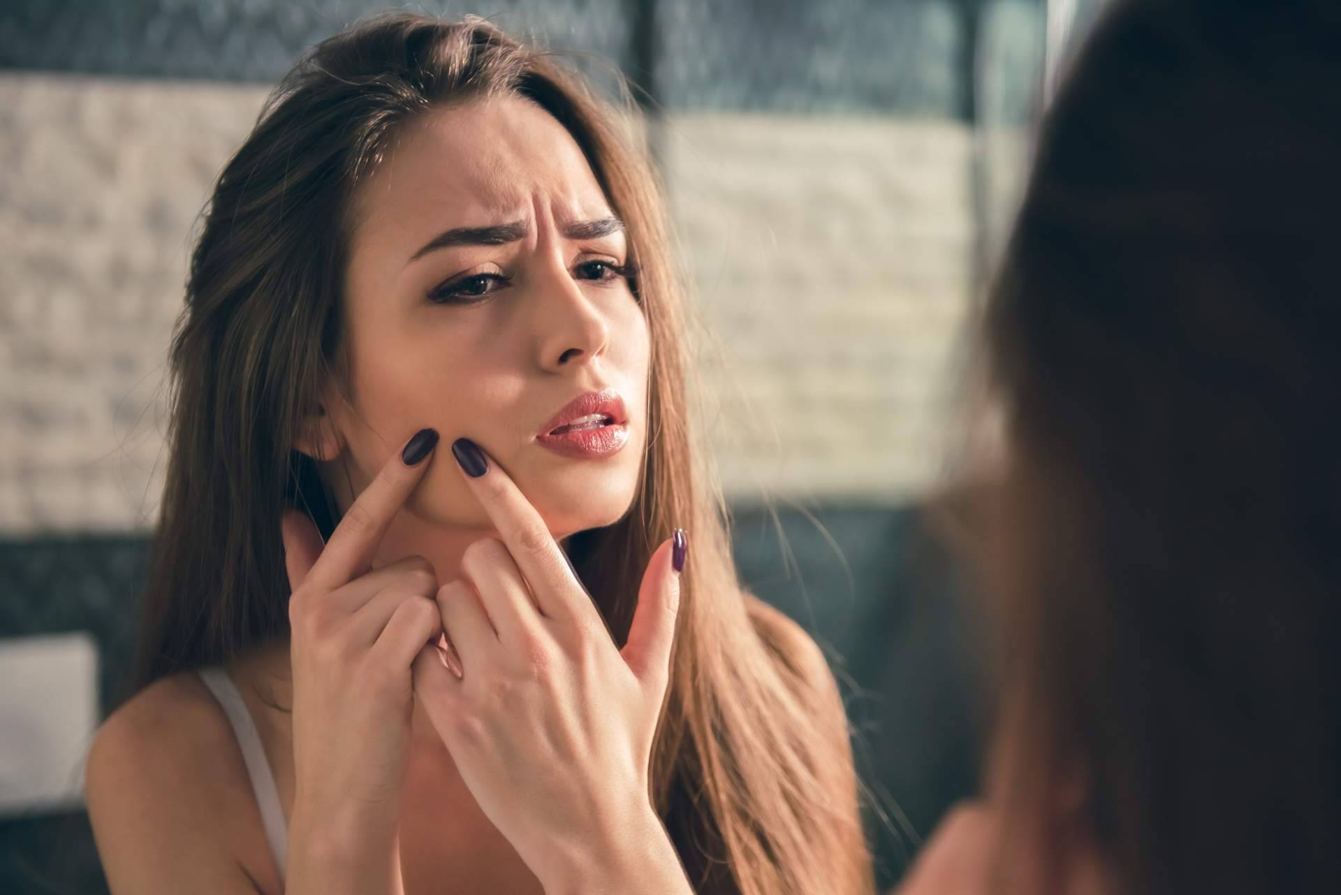 Quitar espinillas y granos con los la app de Acné Xero