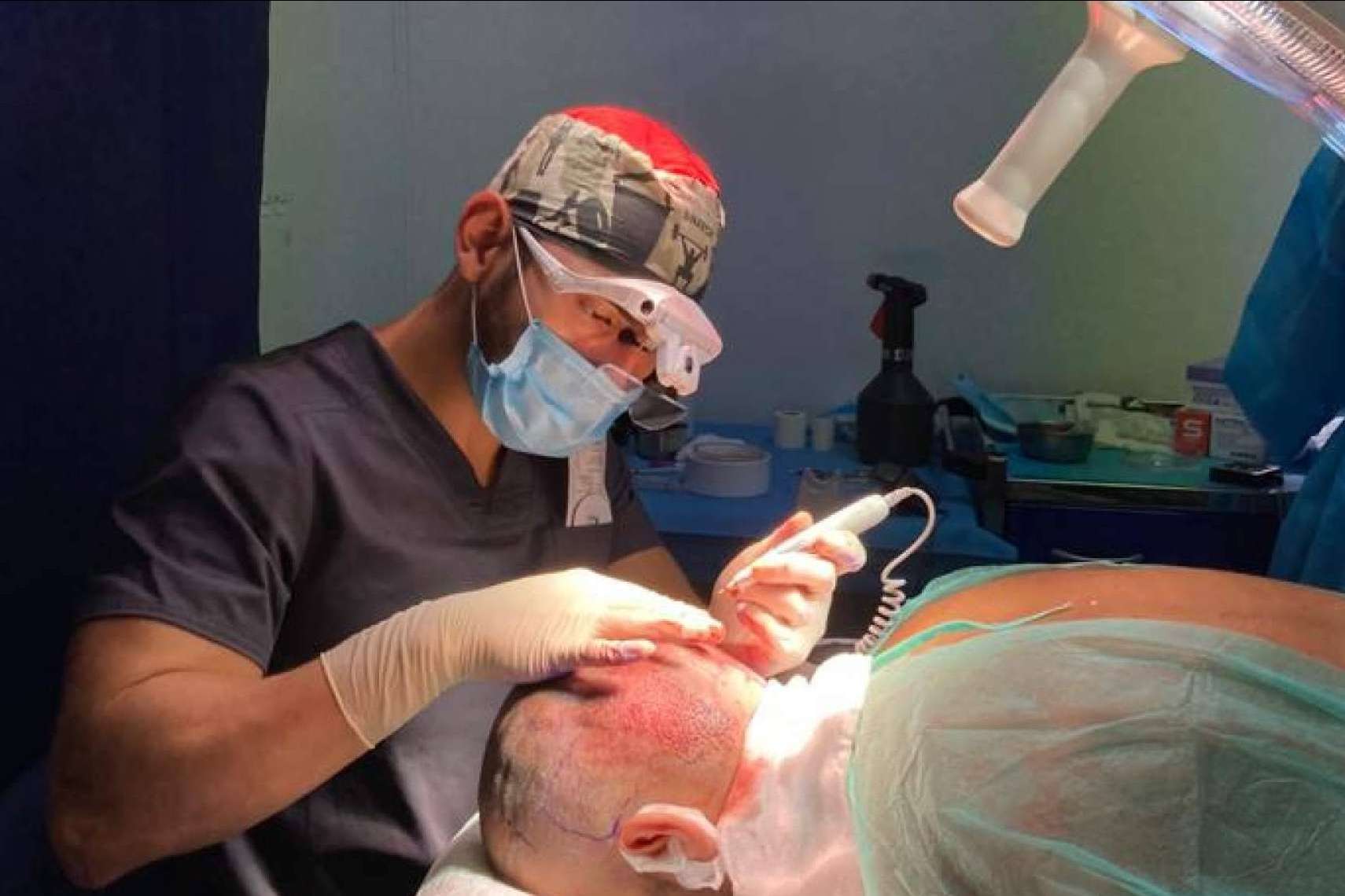 ¿A qué edad es recomendable realizarse un injerto capilar?, por Doctor Bern