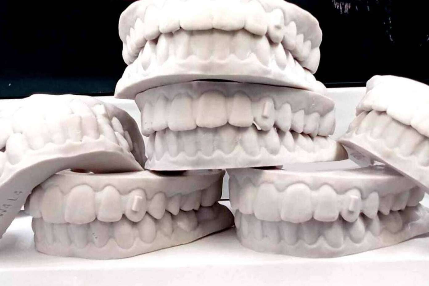 Clínicas Hernadent resuelve las dudas que suelen surgir sobre la ortodoncia invisible