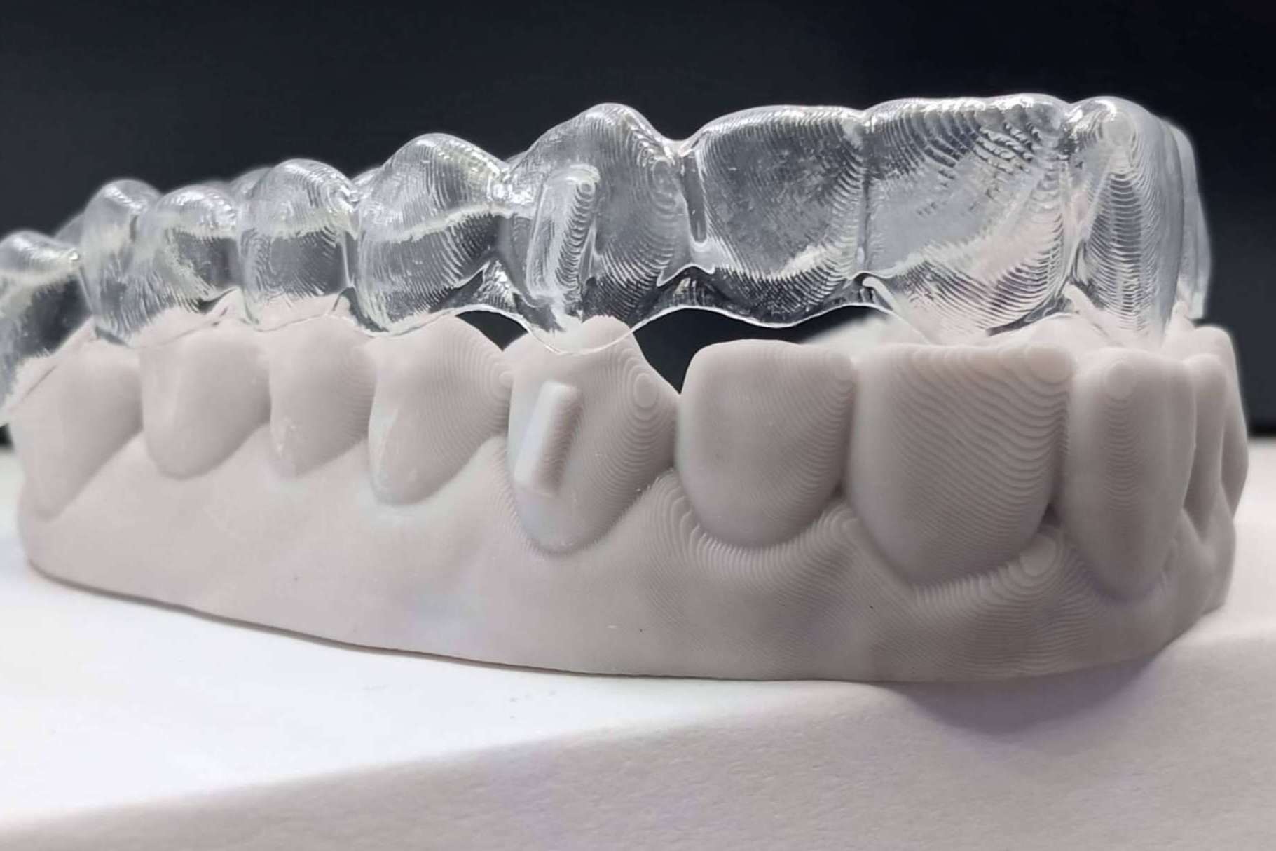 Ortodoncia invisible, la ventaja de elegir Smile Aligner