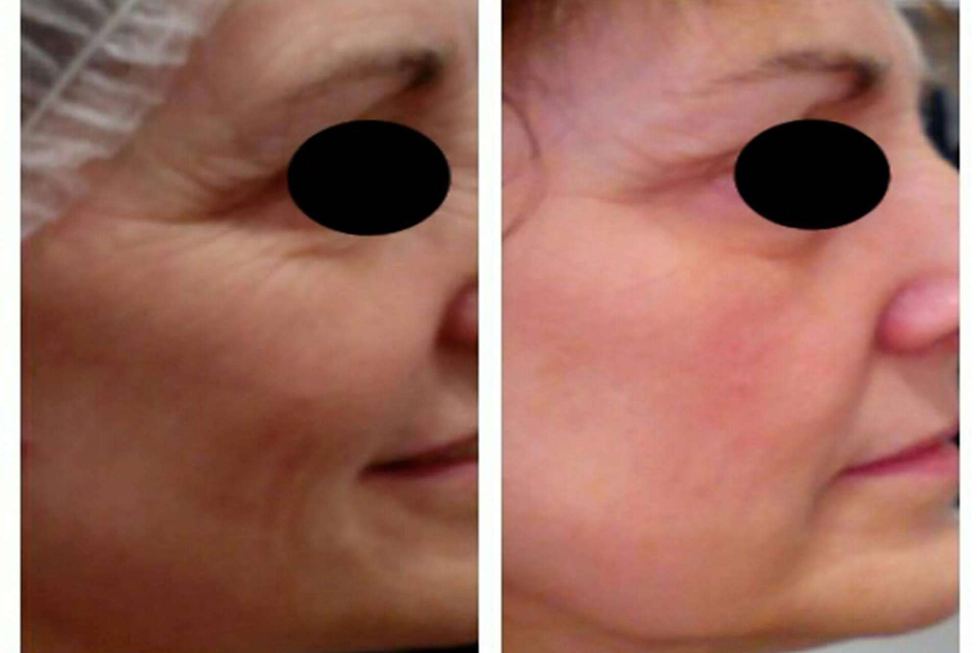 Tratamiento facial antimanchas para lograr una piel de porcelana y otros tratamientos faciales icónicos de MiCleo&Co