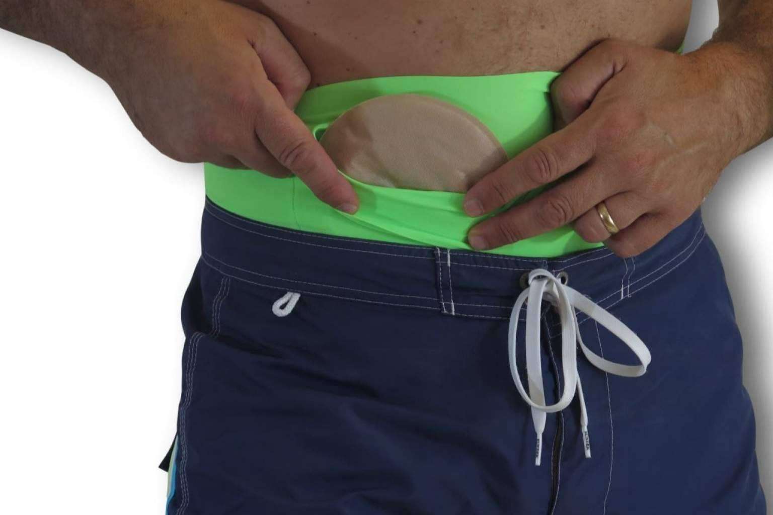 Las fajas para bañarse en la piscina con una ostomía que ofrece Maldita Hernia