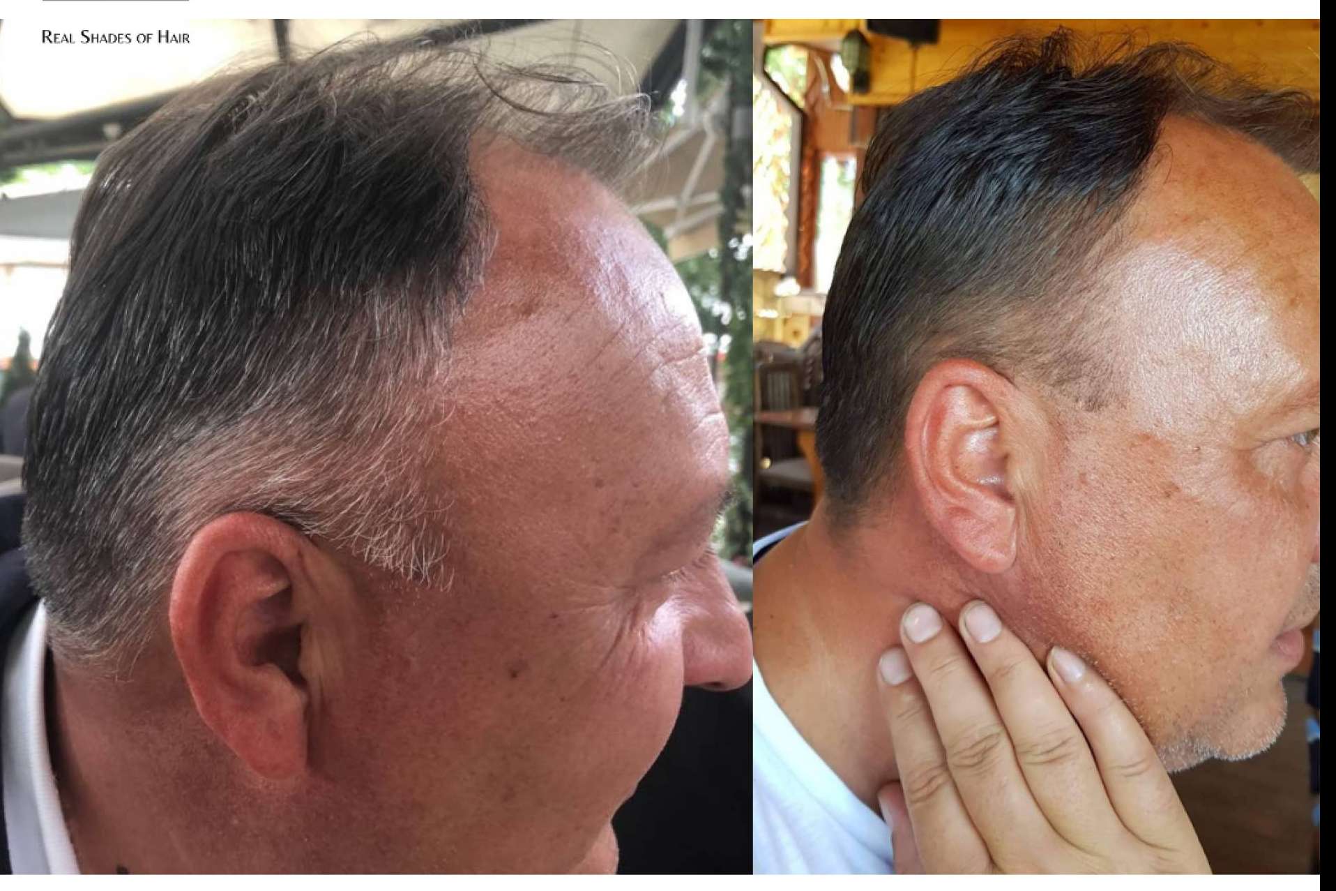 ¿Cuáles son los factores que influyen en la aparición de canas en los jóvenes?