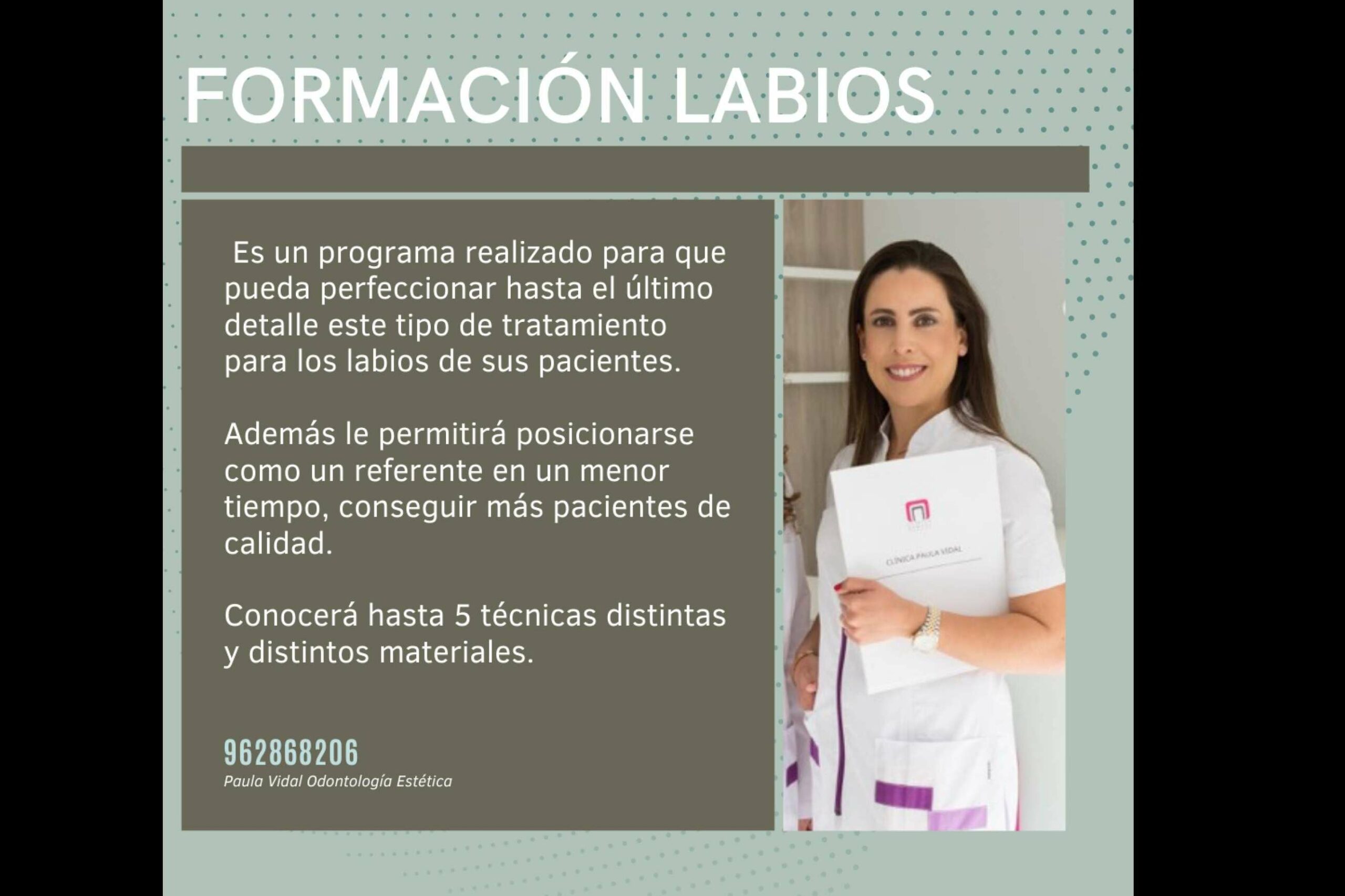 Curso para odontólogos de relleno de ácido hialurónico, por Clínica Paula Vidal