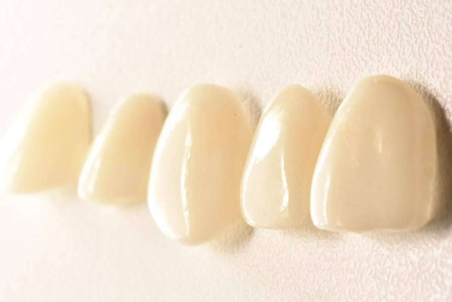 Las amplias ventajas de los tratamientos de estética dental, por Implant Clinics