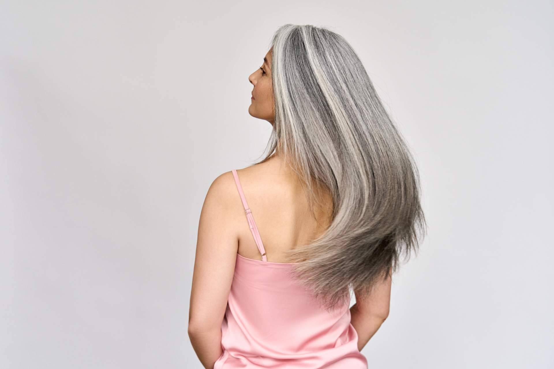 Alopecia e injerto capilar en mujeres, de la mano de MC360