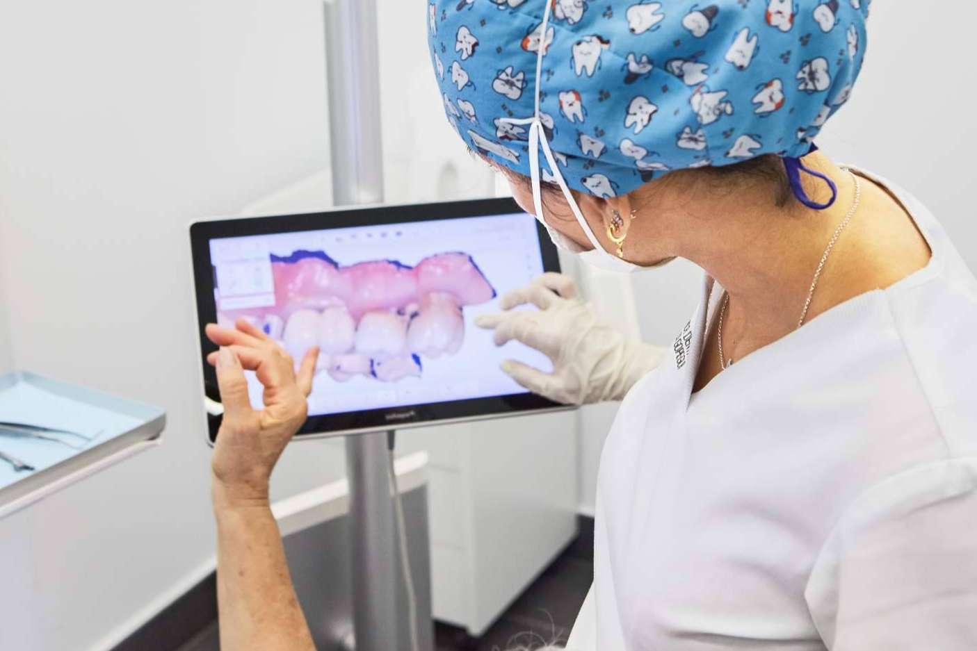 ¿Por qué realizarse un diseño de sonrisa en la Clínica Dental Ruiz de Gopegui?