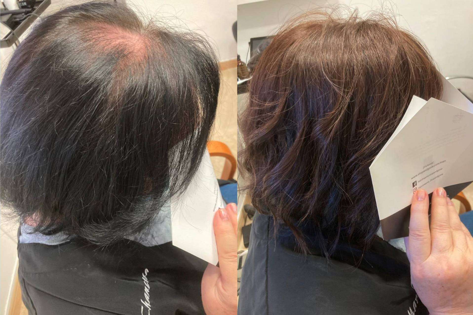 Mar Chancosa coloca extensiones de cabello 100% de cabello natural de Hairdreams