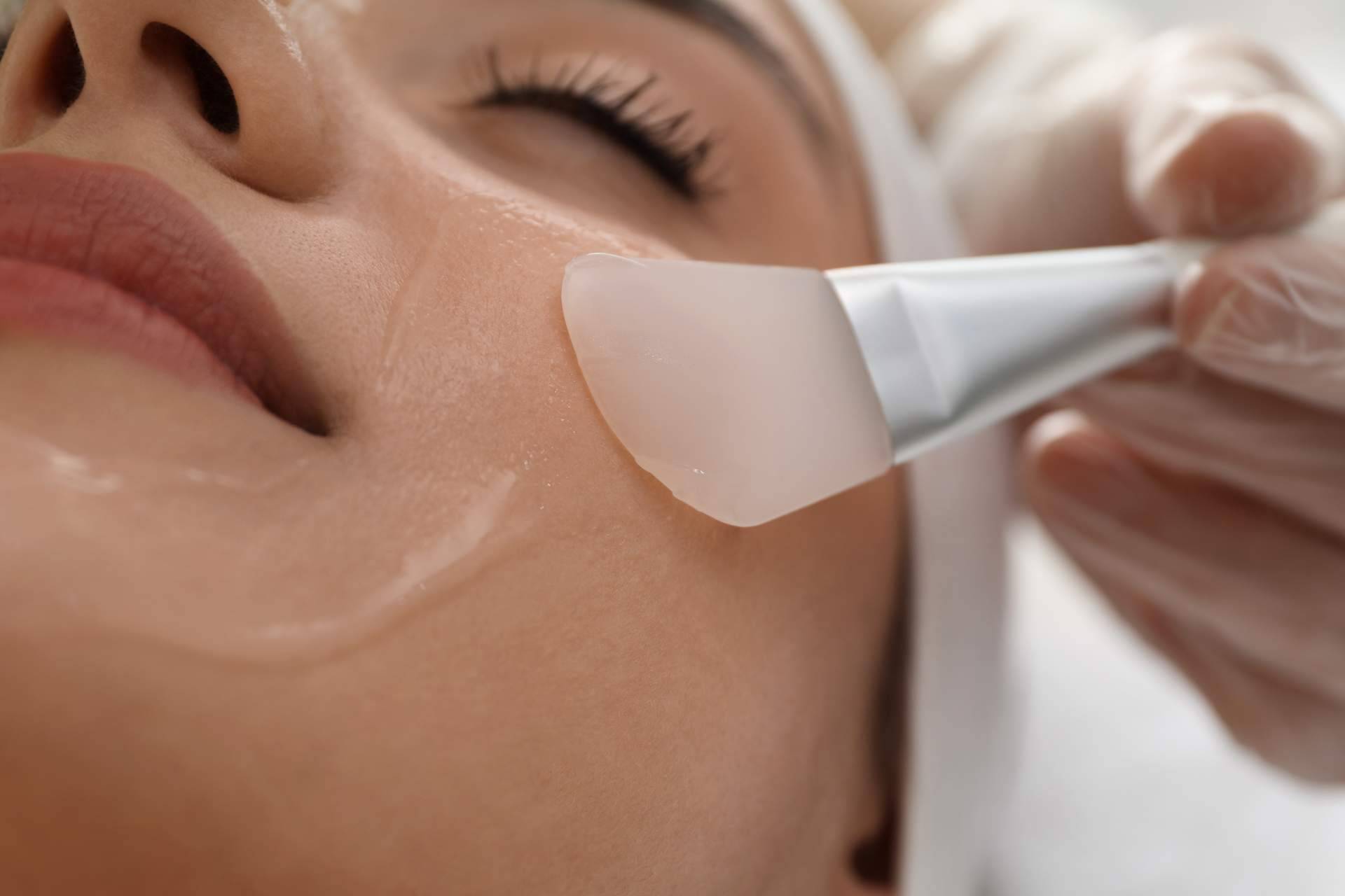 Los peeling químicos de Alluring Clinic como herramienta para luchar contra el envejecimiento facial