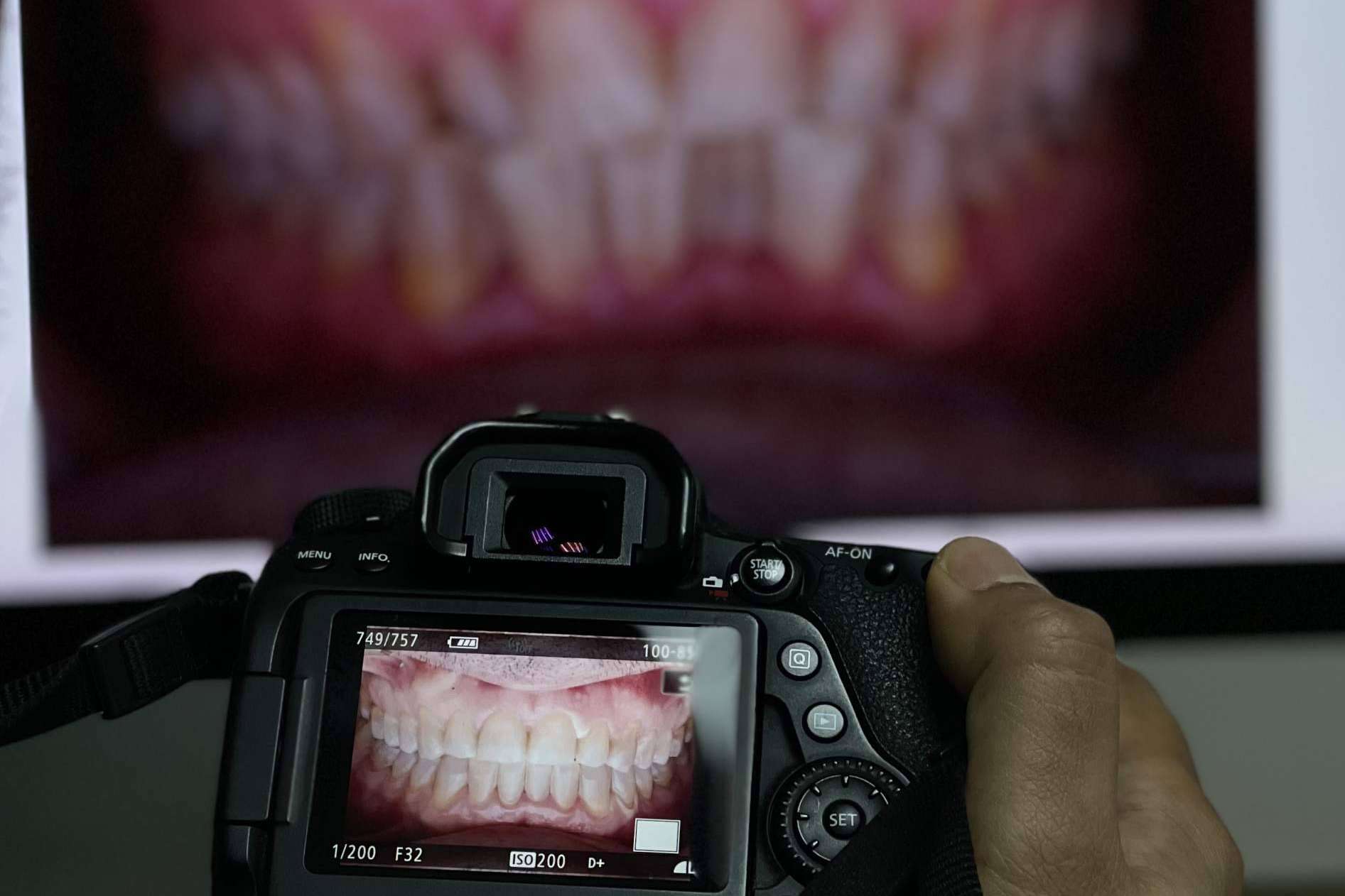La Clínica Los Llanos Dental ofrece tratamientos de odontología infantil en Barcelona
