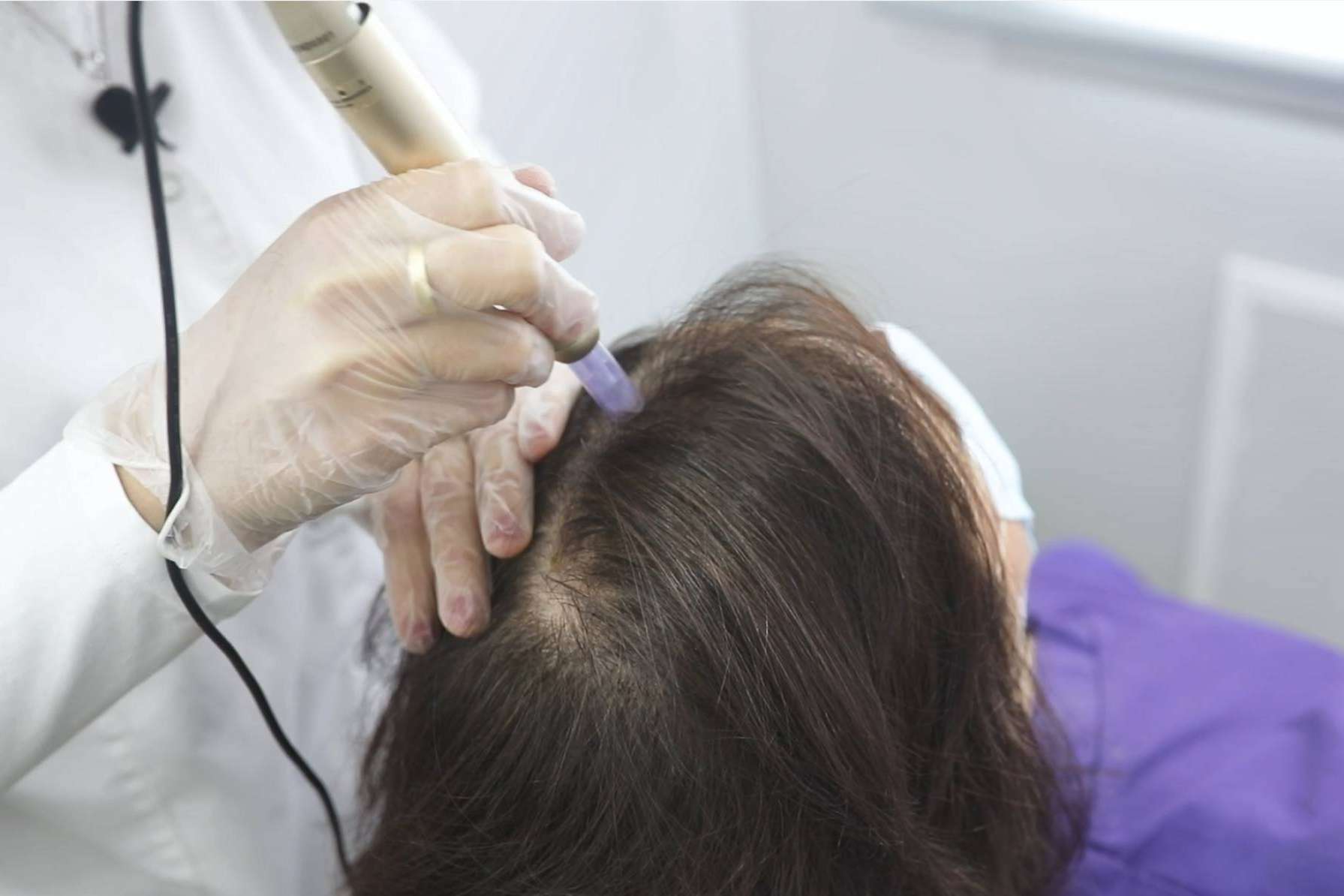 Tratar la alopecia femenina con el innovador tratamiento de bioestimulación del IMD Instituto Médico Dermatológico