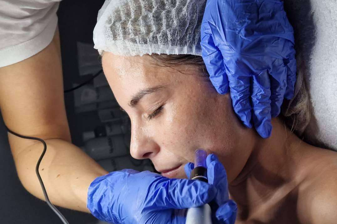 Razones por las que los tratamientos faciales de Las Heroínas son unos de los mejores en la ciudad