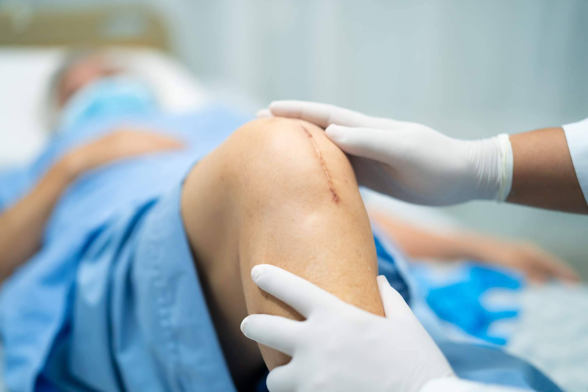 Descifrar el dolor y comenzar el abordaje de la artropatía degenerativa utilizando iXalud