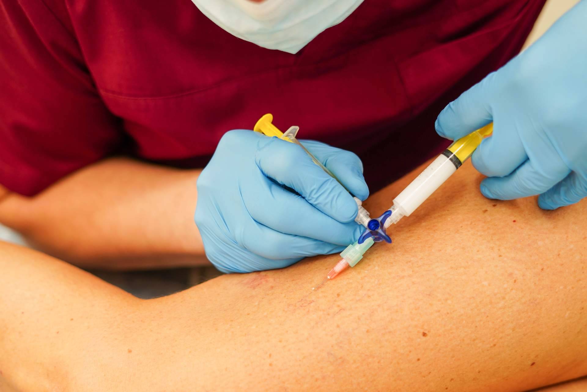 El Centro Estética El Pilar elimina las varices de las piernas en Madrid