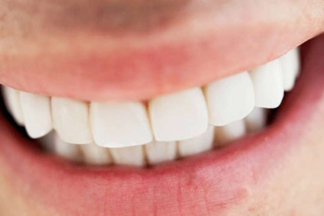 Clínica Dental Jorge del Corral en Hortaleza, Madrid; calidad en prótesis fija estética de zirconio