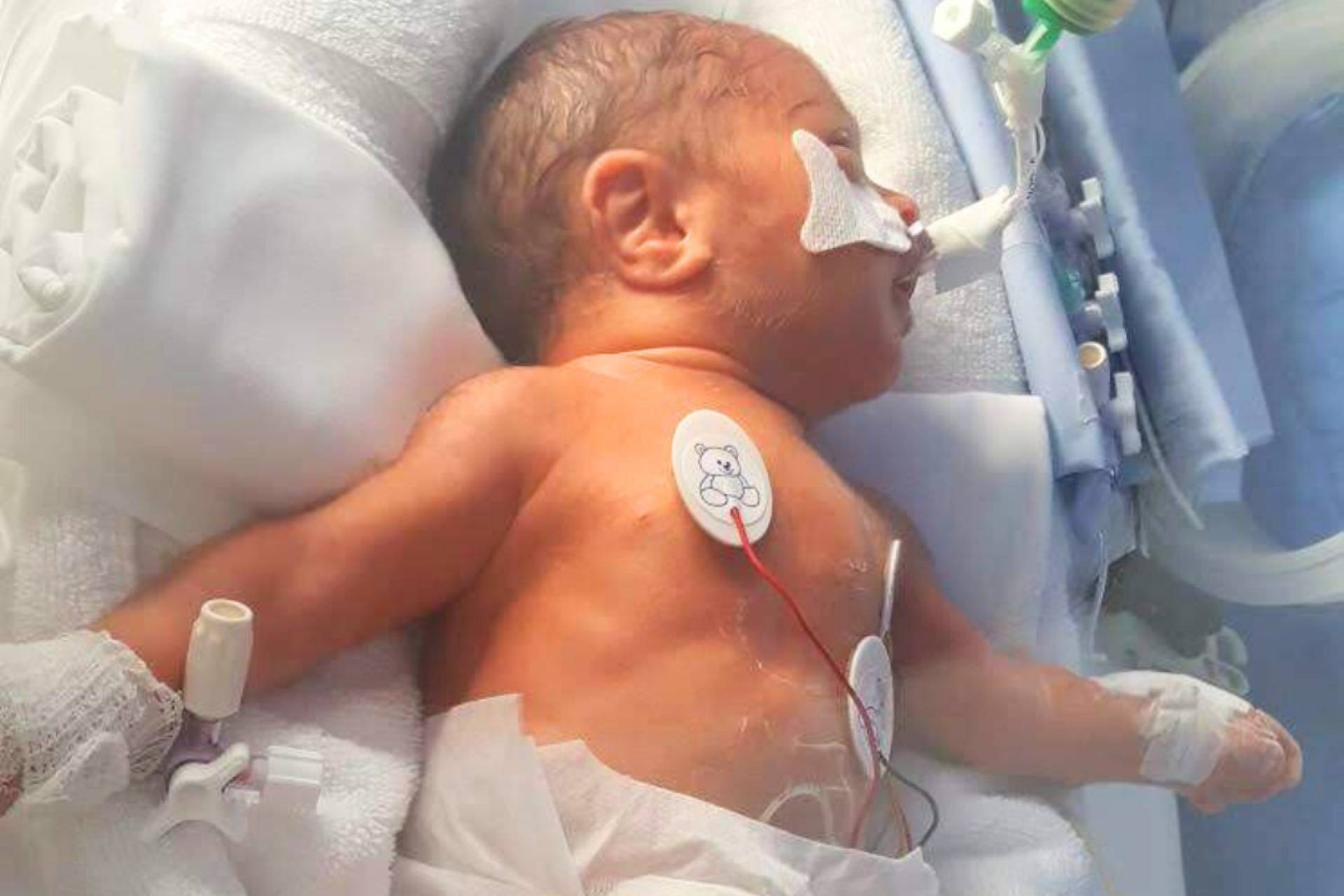 Prematuridad y acompañamiento, la experiencia de familias de bebés prematuros