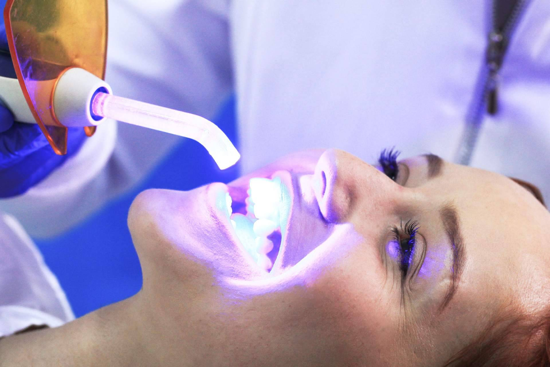 Tendencias 2025; implantes dentales, ortodoncia y diseño de sonrisa en Marlon Becerra